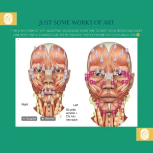 Botox Results & Transformations