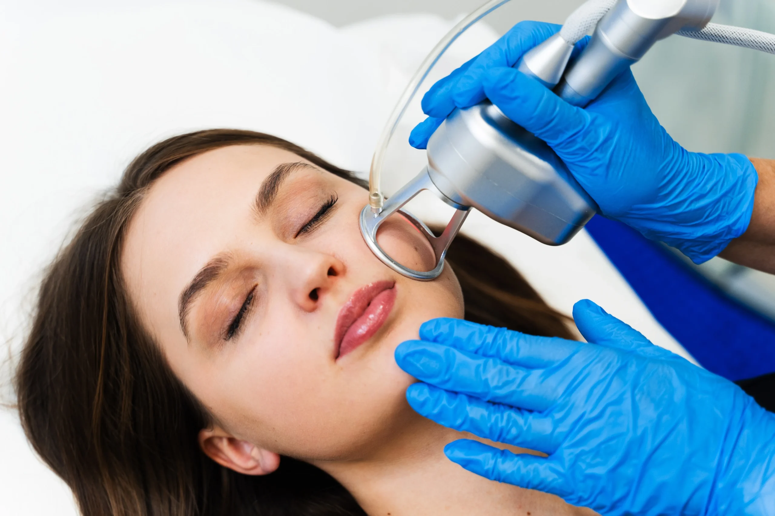 Close-up of a woman receiving facial laser treatment from a gloved professional.