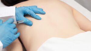 Trigger Point Injection