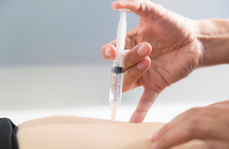 Trigger Point Therapy